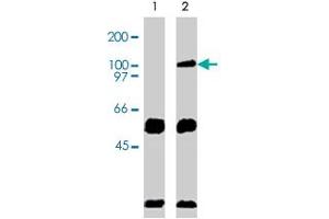 Immunoprecipation results using Western blot analysis. (VAV2 antibody  (AA 578-878))
