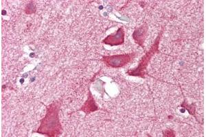 Anti-NKX3-2 antibody IHC staining of human brain, cortex.