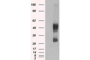 Image no. 4 for anti-Solute Carrier Family 7 (Amino Acid Transporter, L-Type), Member 8 (SLC7A8) antibody (ABIN1500960)