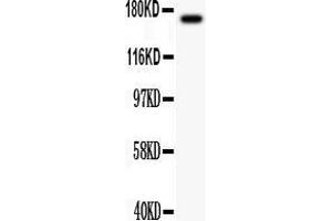 Anti-MEKK1 antibody, Western blotting All lanes: Anti MEKK1  at 0. (MAP3K1 antibody  (C-Term))