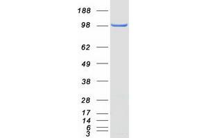 Validation with Western Blot