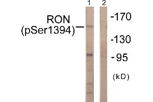 Western blot analysis of extracts from HeLa cells, treated with TNF-a (20ng/ml, 2mins), using CD136/RON (Phospho-Ser1394) antibody. (MST1R antibody  (pSer1394))