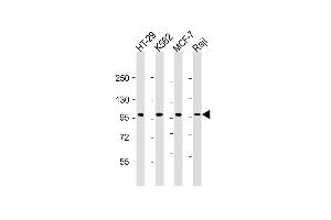 All lanes : Anti-TPX2 Antibody at 1:2000 dilution Lane 1: HT-29 whole cell lysate Lane 2: K562 whole cell lysate Lane 3: MCF-7 whole cell lysate Lane 4: Raji whole cell lysate Lysates/proteins at 20 μg per lane. (TPX2 antibody  (AA 1-531))