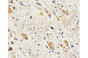 IHC-P: Dopamine Receptor D3 antibody testing of rat brain tissue (DRD3 antibody  (C-Term))