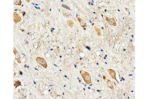 IHC-P: Dopamine Receptor D3 antibody testing of rat brain tissue
