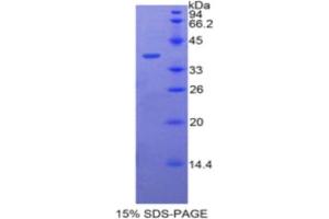 SDS-PAGE analysis of Human BPI Protein.