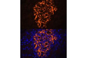 Immunofluorescence analysis of rat pancreas using PNLIPRP2 antibody (ABIN6130643, ABIN6145842, ABIN6145843 and ABIN6216695) at dilution of 1:100. (PNLIPRP2 antibody  (AA 301-470))