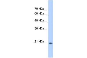 WB Suggested Anti-GINS2 Antibody Titration:  0. (GINS2 antibody  (C-Term))