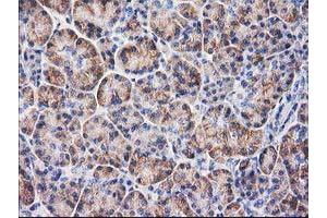 Immunohistochemistry (IHC) image for anti-Beclin 1, Autophagy Related (BECN1) antibody (ABIN1496867)