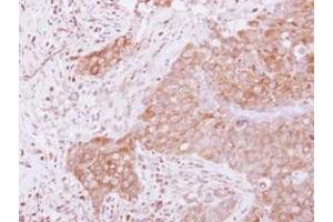Image no. 1 for anti-G1 To S Phase Transition 1 (GSPT1) (AA 1-637) antibody (ABIN1498536) (GSPT1 antibody  (AA 1-637))