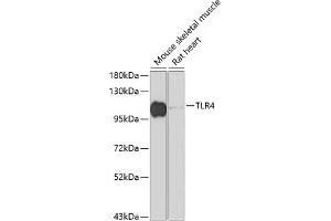 Western blot analysis of extracts of various cell lines, using TLR4 antibody (ABIN6134488, ABIN6149222, ABIN6149225 and ABIN6215119) at 1:1000 dilution. (TLR4 antibody  (AA 500-600))