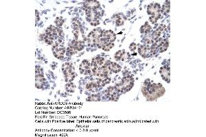 Human Pancreas (XRCC5 antibody  (C-Term))