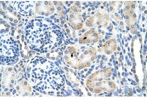 Human kidney (SPPL2B antibody  (N-Term))