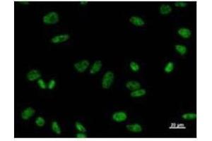 Immunostaining analysis in HeLa cells. (PRPF8 antibody)