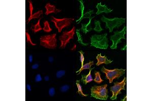 ABIN6260811 and ABIN6272991 staining Hela cells by IF/ICC. (CHMP2A antibody  (Internal Region))