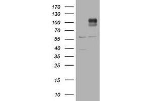 Western Blotting (WB) image for anti-ADAM Metallopeptidase with thrombospondin Type 1 Motif, 8 (ADAMTS8) antibody (ABIN1496472) (ADAMTS8 antibody)