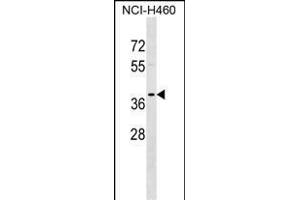 T Antibody (C-term) (ABIN1536948 and ABIN2849142) western blot analysis in NCI- cell line lysates (35 μg/lane).