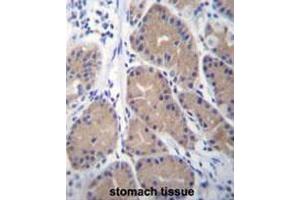 CA1 Antibody (N-term) immunohistochemistry analysis in formalin fixed and paraffin embedded human stomach tissue followed by peroxidase conjugation of the secondary antibody and DAB staining. (CA1 antibody  (N-Term))