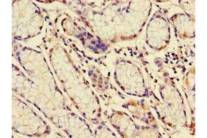 Immunohistochemistry (IHC) image for anti-Mucin 1 (MUC1) (AA 24-273) antibody (ABIN7160277)