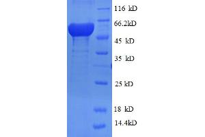 SDS-PAGE (SDS) image for Ribonucleotide Reductase M2 (RRM2) (AA 1-389), (full length) protein (His-SUMO Tag) (ABIN5710284)