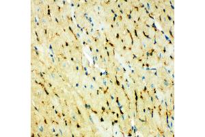 Immunohistochemistry (IHC) image for anti-Fatty Acid Binding Protein 5 (Psoriasis-Associated) (FABP5) (AA 10-23), (N-Term) antibody (ABIN3044084)