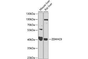 Western blot analysis of extracts of various cell lines, using ZDHHC9 antibody (ABIN6131130, ABIN6150420, ABIN6150421 and ABIN6223988) at 1:1000 dilution. (ZDHHC9 antibody  (AA 250-364))