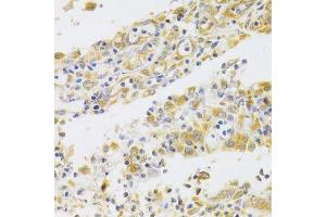 Immunohistochemistry (Paraffin-embedded Sections) (IHC (p)) image for anti-Proliferation-Associated 2G4, 38kDa (PA2G4) (AA 1-394) antibody (ABIN6145146)