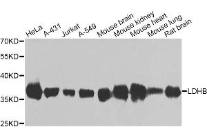 Western blot analysis of extracts of various cell lines, using LDHB antibody (ABIN5975613) at 1/1000 dilution. (LDHB antibody)