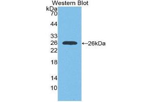 Western Blotting (WB) image for anti-Insulin-Like Growth Factor 1 Receptor (IGF1R) (AA 763-955) antibody (ABIN1868503) (IGF1R antibody  (AA 763-955))