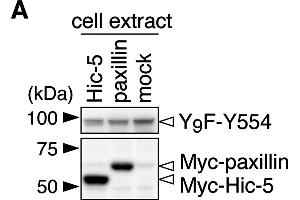Git1 phosphorylation at Tyr-554 was enhanced by co-expression of paxillin. (Myc Tag antibody)