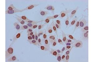 Immunocytochemistry analysis of Hela cells using ABIN7139669 at dilution of 1:100 (HIST1H3A antibody  (3meLys36))