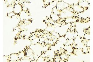 ABIN6272956 at 1/100 staining Mouse lung tissue by IHC-P. (C9ORF72 antibody  (Internal Region))