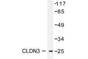 Image no. 2 for anti-Claudin 3 (CLDN3) antibody (ABIN265362)