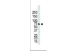 Western blot analysis of anti-BR1B Pab ap2005b in NCI- cell lysate. (BMPR1B antibody  (C-Term))