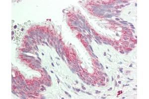 Human Lung: Formalin-Fixed, Paraffin-Embedded (FFPE). (AREL1 antibody  (AA 179-228))