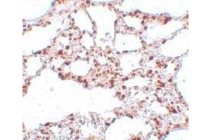 Immunohistochemistry of ZSCAN4 in rat lung tissue with this product at 5 μg/ml. (ZSCAN4 antibody  (C-Term))