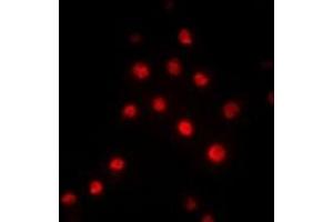 Immunofluorescent analysis of RBBP5 staining in Hela cells. (RBBP5 antibody)