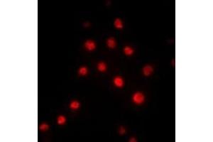 Immunofluorescent analysis of RBBP5 staining in Hela cells.