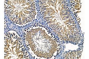 ABIN7095404 and ABIN7099461 at 1/100 staining rat testis tissue by IHC-P.