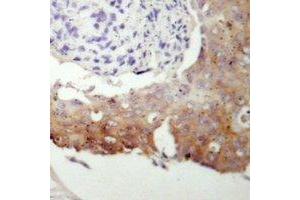 Immunohistochemistry (IHC) image for anti-Protein Kinase, CGMP-Dependent, Type II (PRKG2) (N-Term) antibody (ABIN7304050)