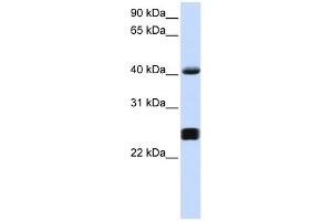 WB Suggested Anti-SERPINA3 Antibody Titration: 0. (SERPINA3 antibody  (Middle Region))