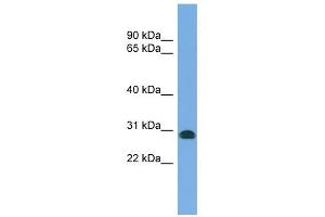 CENPH antibody used at 1 ug/ml to detect target protein. (CENPH antibody  (N-Term))