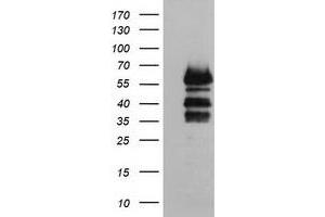 Image no. 1 for anti-Vasodilator-Stimulated phosphoprotein (VASP) antibody (ABIN1501697) (VASP antibody)