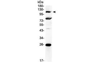 Western blot testing of human 22RV1 cell lysate with NFAT4 antibody at 0. (NFATC3 antibody)