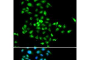 Immunofluorescence analysis of MCF-7 cells using SBDS Polyclonal Antibody (SBDS antibody)