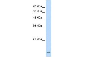 WB Suggested Anti-UBE2I Antibody Titration:  2. (UBE2I antibody  (Middle Region))