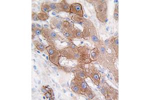 Immunohistochemistry (Paraffin-embedded Sections) (IHC (p)) image for anti-Cytochrome P450, Family 3, Subfamily A, Polypeptide 5 (CYP3A5) (AA 476-502), (C-Term) antibody (ABIN392224)