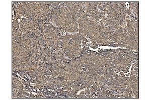 IHC analysis of Arginine Decarboxylase/AZIN2 using anti-Arginine Decarboxylase/AZIN2 antibody (ABIN7599403). (ADC antibody  (AA 1-448))