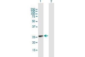 Western Blot analysis of KIAA1109 expression in transfected 293T cell line by KIAA1109 MaxPab polyclonal antibody. (Fetal Sulfoslycoprotein Antigen (FSA) (AA 1-191) antibody)
