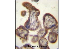 CGB/HCG-Beta Antibody (C-term) (ABIN656960 and ABIN2846144) immunohistochemistry analysis in formalin fixed and paraffin embedded human placenta tissue followed by peroxidase conjugation of the secondary antibody and DAB staining. (CGB antibody  (C-Term))